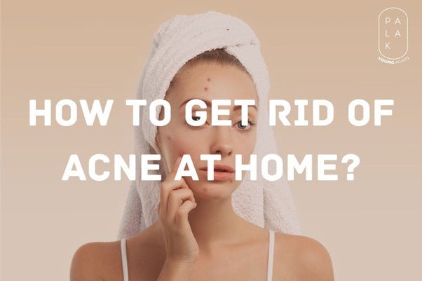 How to get rid of Acne at Home? - Palak Notes