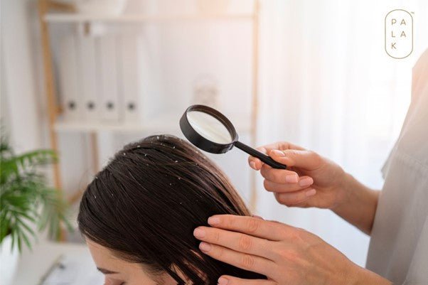 How to get rid of Dandruff at Your Home? - Palak Notes