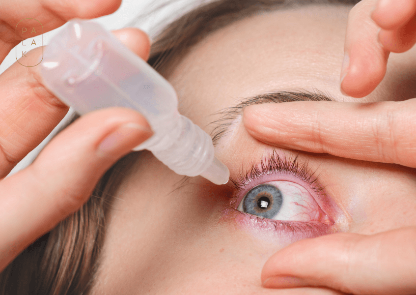How to Naturally Cure Chronic Dry Eyes Permanently - Palak Notes