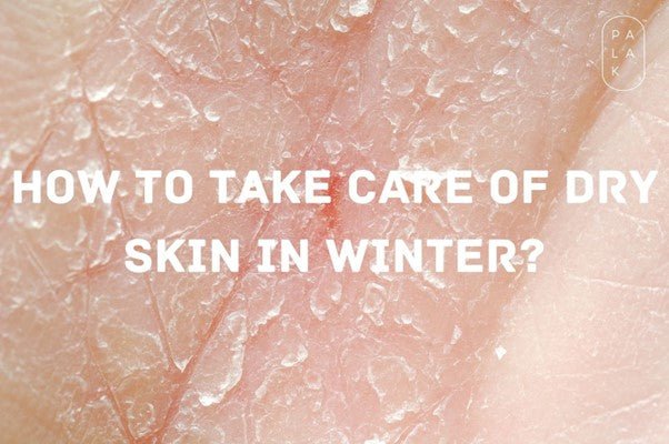 How to Take Care of Your Dry Skin in Winter? - Palak Notes