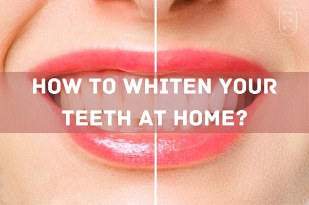 How to Whiten Your Teeth at Home? - Palak Notes