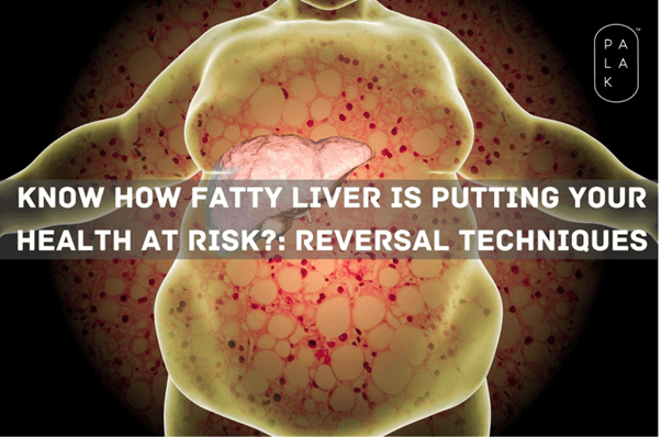 Know how Fatty Liver is Putting Your Health at Risk and its Reversal Techniques!! - Palak Notes